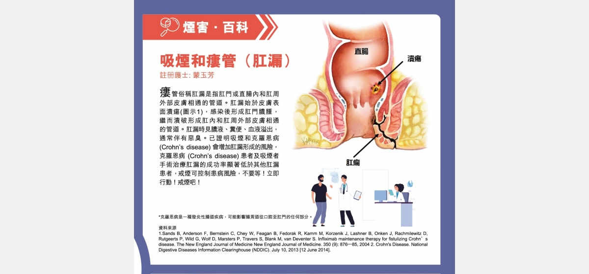509137_LST_愛無煙_Newsletter_Vol28_04_OP_Cut-05